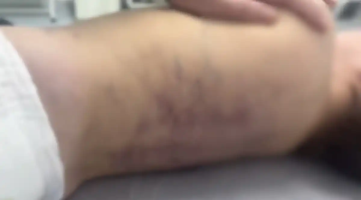 В Талдыкоргане мужчина жестоко избил собственного трёхлетнего сына